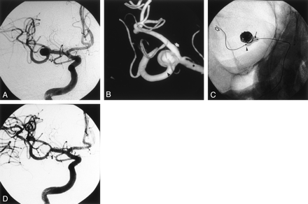 Fig 2.