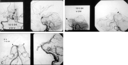 Fig 1.