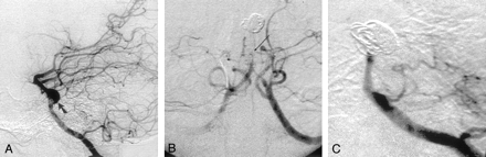 Fig 2.