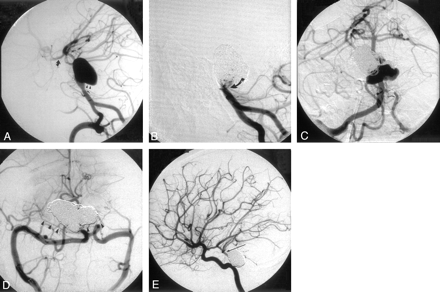 Fig 3.