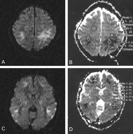 Fig 2.