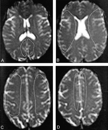 Fig 2.