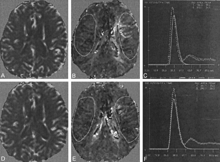 Fig 3.