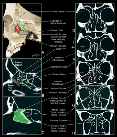 Fig 4.