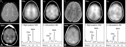 Fig 3.