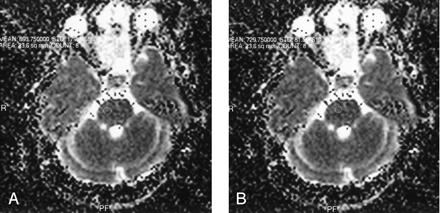 Fig 2.