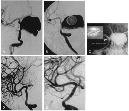 Fig 2.