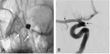 Fig 2.