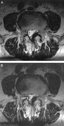 Fig 3.