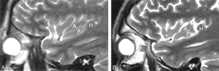 Fig 6.