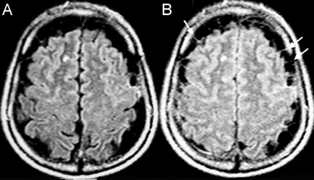 Fig 2.