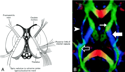 Fig 12.