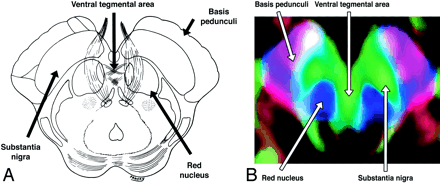 Fig 16.