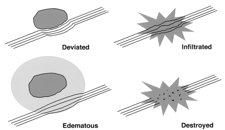 Fig 18.