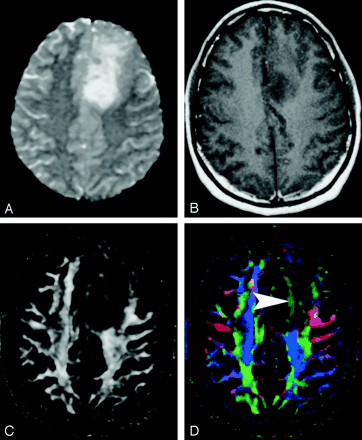 Fig 21.