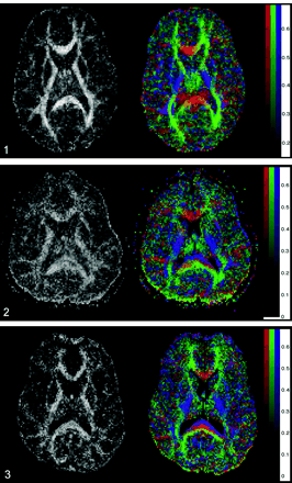 Fig 3.