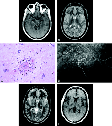 Fig 2.