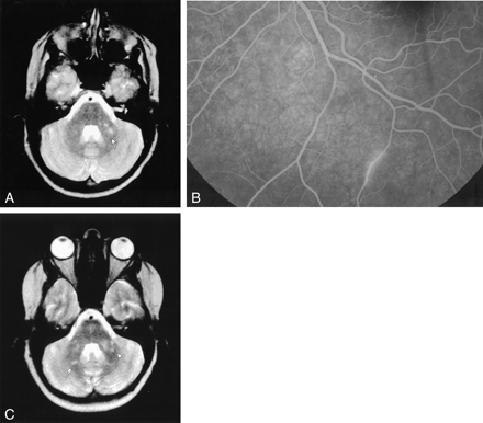 Fig 4.