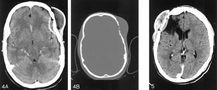 Fig 4.