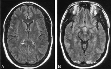 Fig 1.