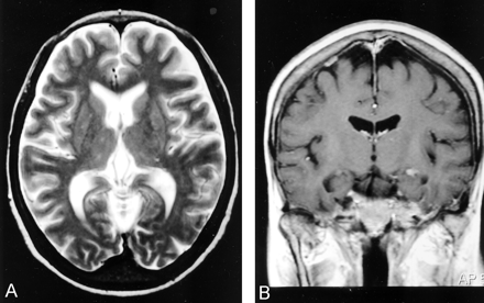 Fig 1.