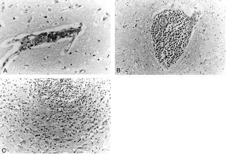 Fig 4.