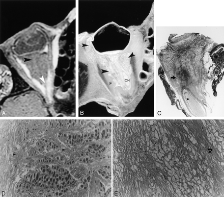 Fig 3.