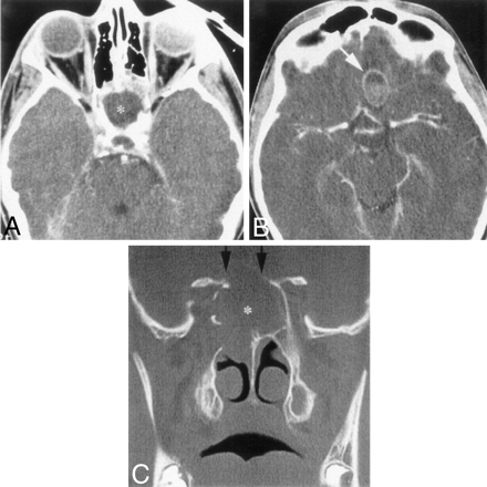 Fig 1.