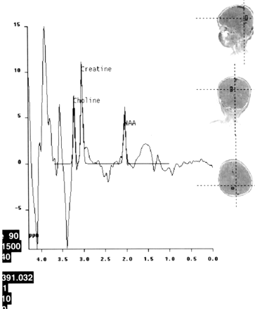 Fig 3.