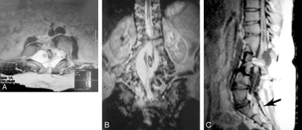 Fig 3.