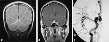 Fig 3.