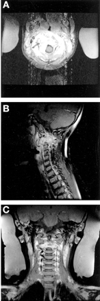 Fig 2.