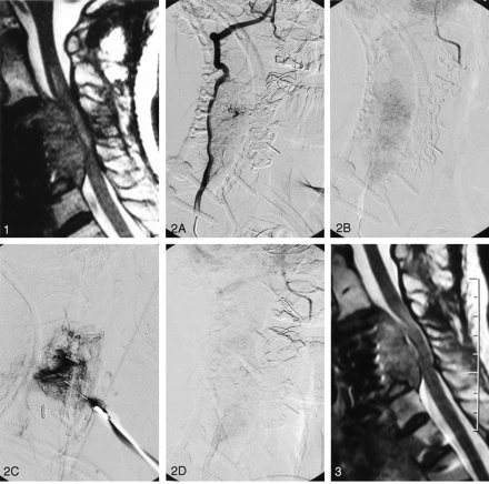 Fig 3.