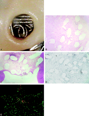 Fig 2.