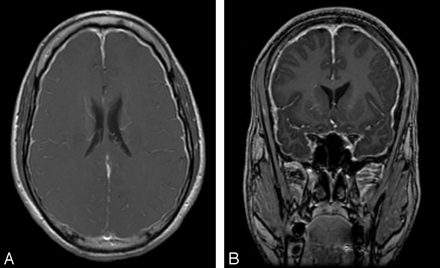 Fig 2.