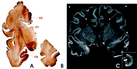 Fig 6.