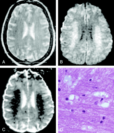 Fig 15.