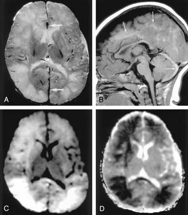 Fig 7.