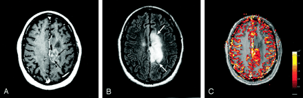 Fig 4.