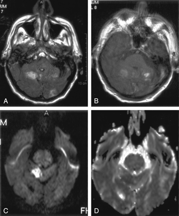 Fig 4.