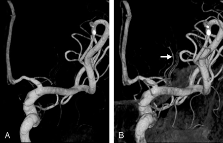 Fig 1.