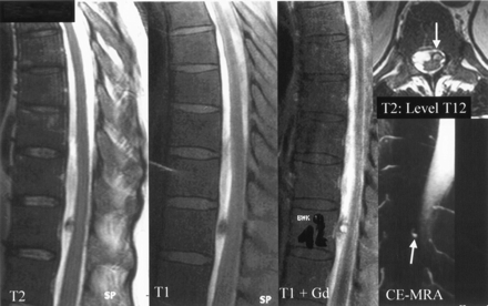 Fig 3.