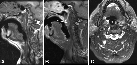 Fig 3.