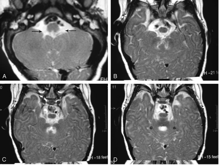 Fig 2.