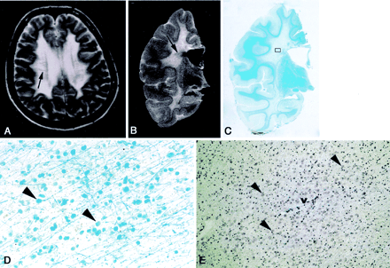 Fig 2.