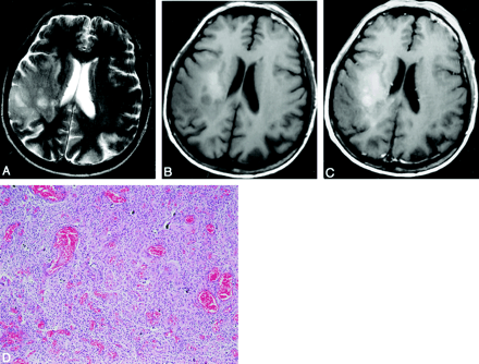 Fig 4.