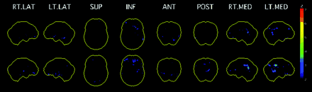 Fig 3.