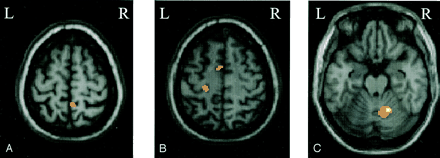 Fig 1.