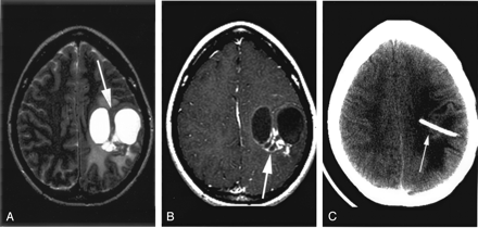 Fig 2.