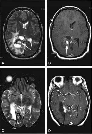 Fig 3.